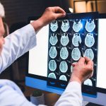 4 Game-Changing Ways Functional Medicine Tackles Neurodegenerative Diseases