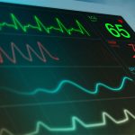 AI Can Now Predict Heart Failure Risk from a Simple ECG!