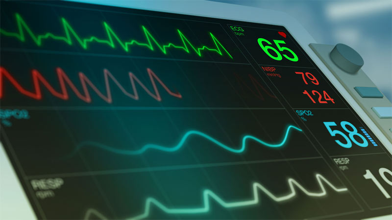 AI Can Now Predict Heart Failure Risk from a Simple ECG!